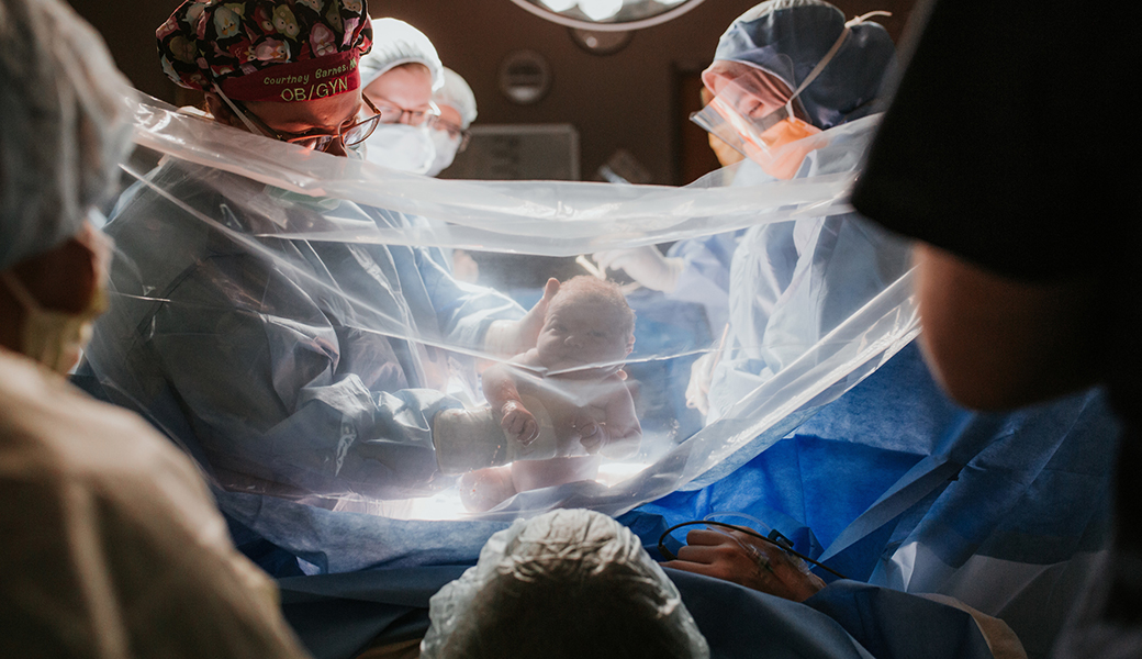 a gentler c section gentle cesarean birth plan