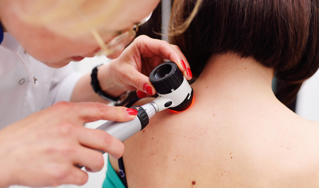 Take Steps to Protect Yourself from Skin Cancer