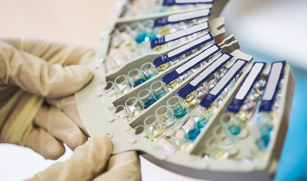 Breaking Down Antibody Testing