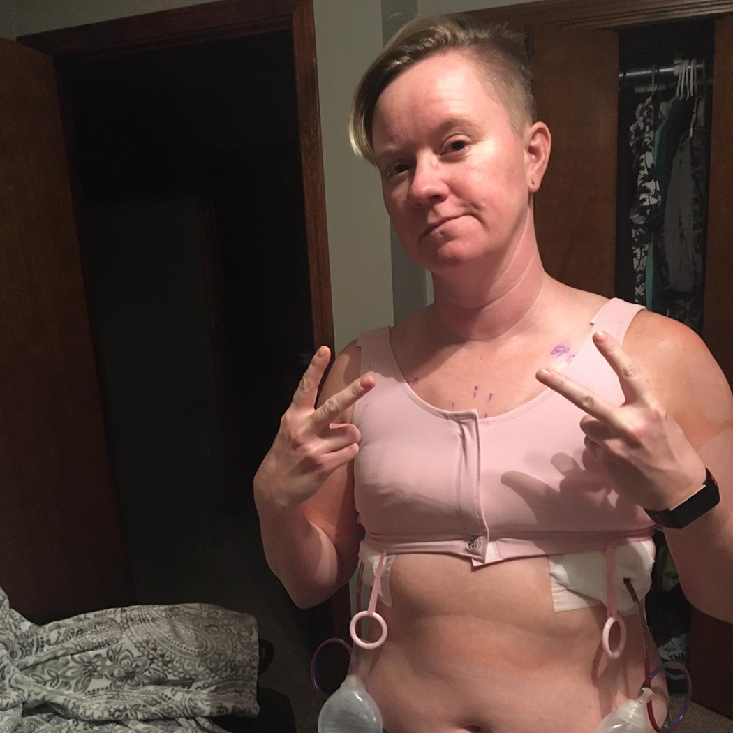 Breast cancer husband loves big boobs 10 Days Left With The Girls One Woman S Countdown To A Double Mastectomy