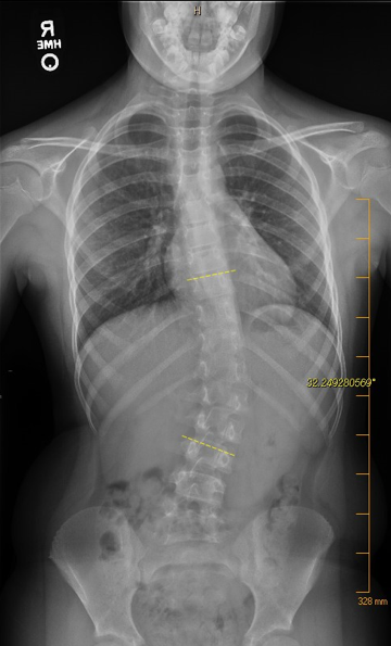 Before x-ray