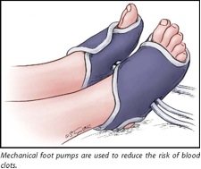 foot pumps diagram