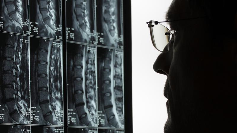 doctor looking at xray