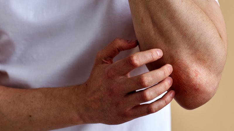 A photo of a person scratching their elbow.
