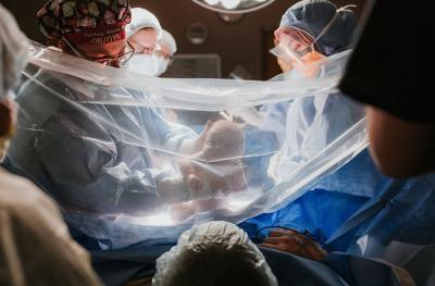 gentle C-section