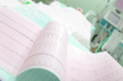 Photo of cardiogram