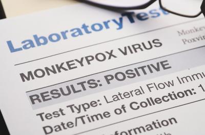 monkey pox document