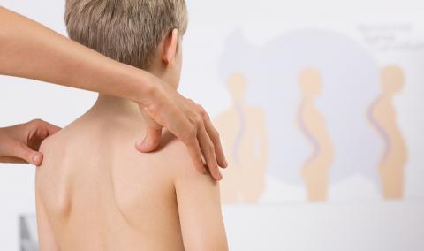 Child with scoliosis