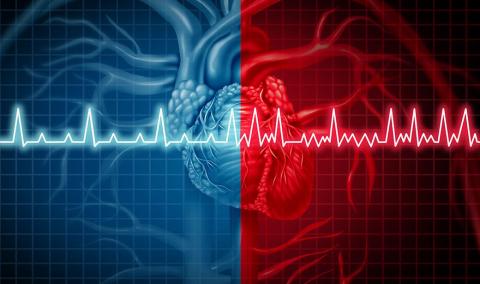 AFib graphic