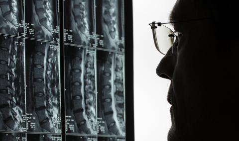 doctor looking at xray