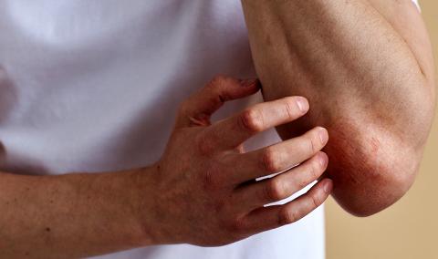 A photo of a person scratching their elbow.