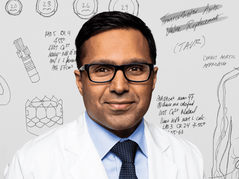 Arun Kumar, MD, interventional cardiologist