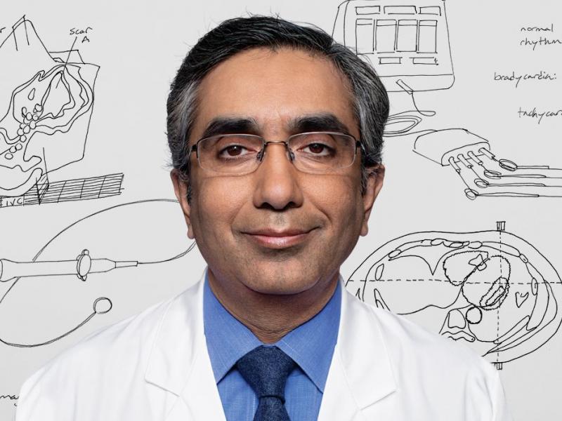 Sandeep Gautam, MD, Cardiac Electrophysiologist