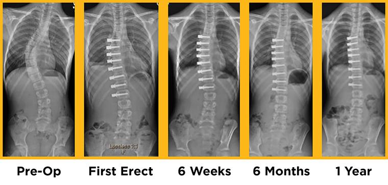 VBT-OP xray