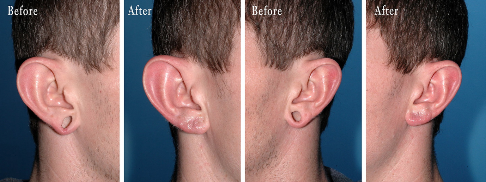 Ear