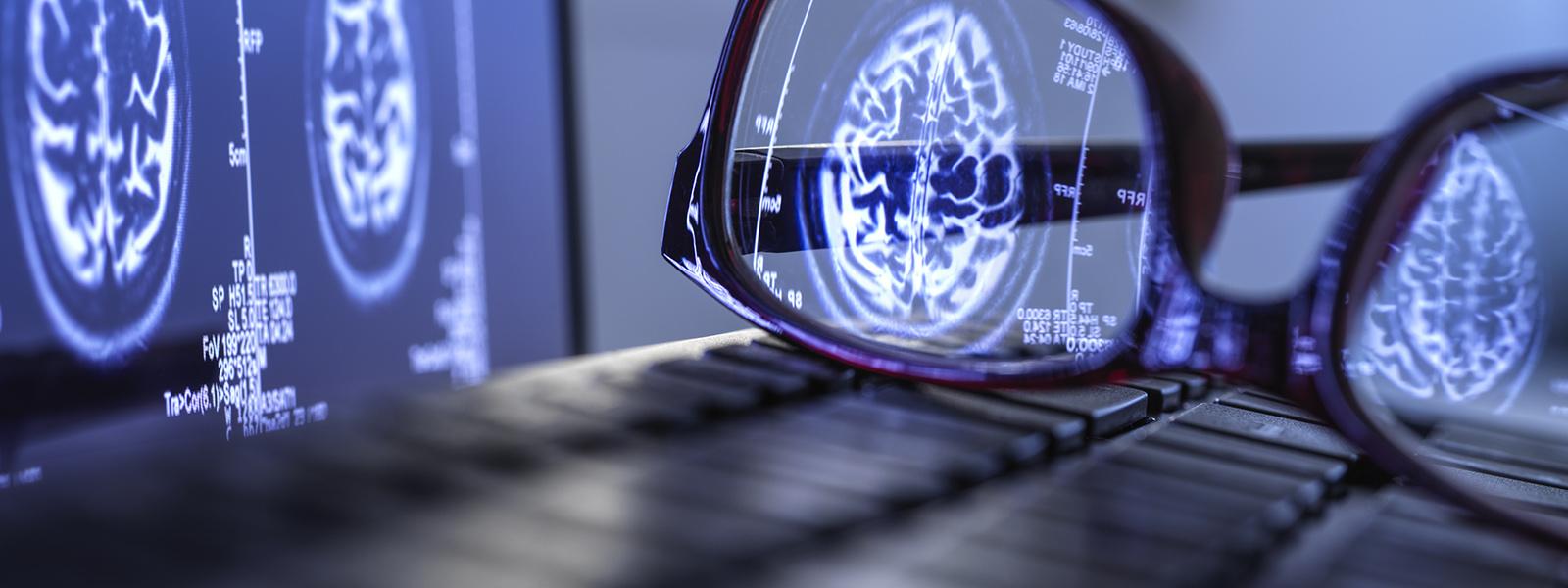 brain scan on a pc screen